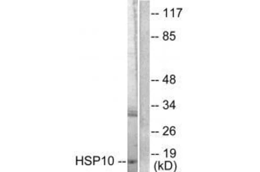 Western blot - HSP10 Antibody from Signalway Antibody (33405) - Antibodies.com