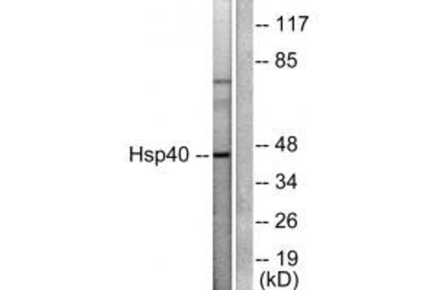 Western blot - HSP40 Antibody from Signalway Antibody (33407) - Antibodies.com