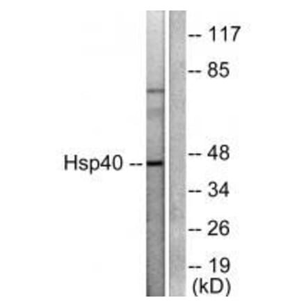 Western blot - HSP40 Antibody from Signalway Antibody (33407) - Antibodies.com