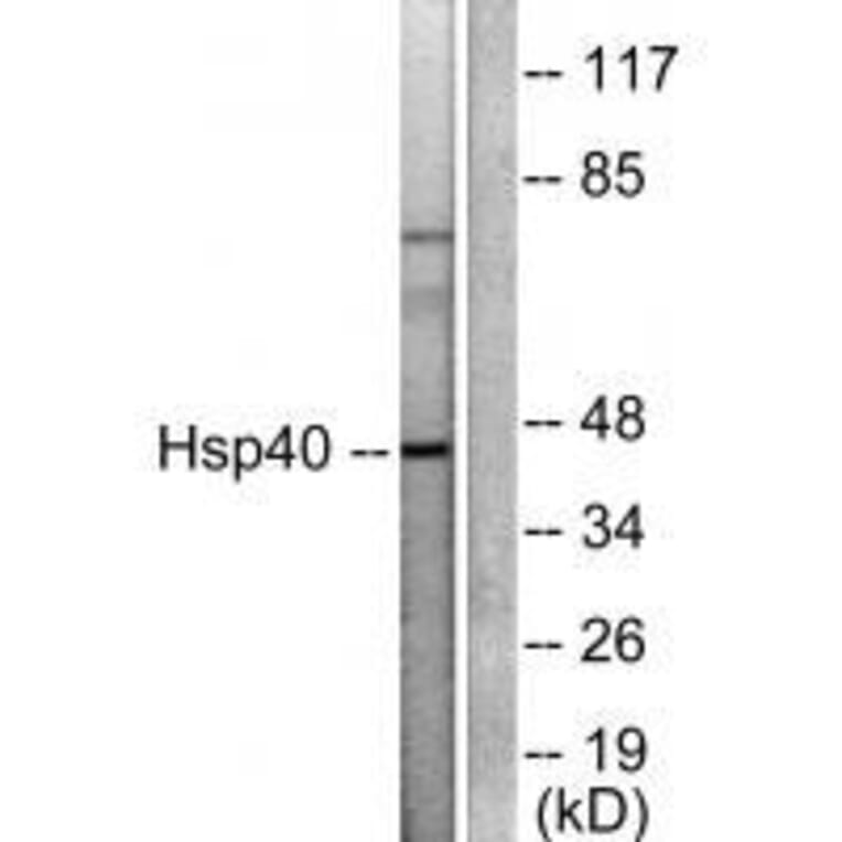 Western blot - HSP40 Antibody from Signalway Antibody (33407) - Antibodies.com