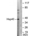 Western blot - HSP40 Antibody from Signalway Antibody (33407) - Antibodies.com