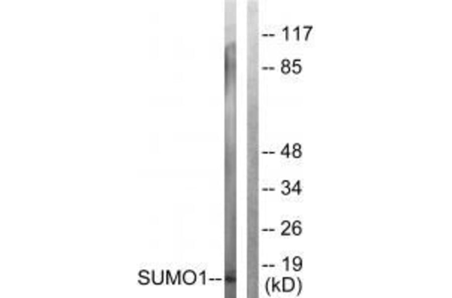 Western blot - Sumo1 Antibody from Signalway Antibody (33525) - Antibodies.com