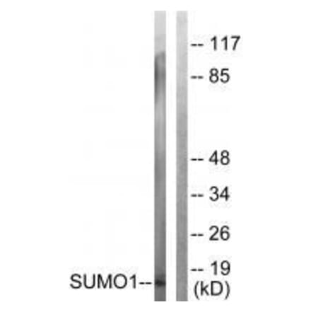 Western blot - Sumo1 Antibody from Signalway Antibody (33525) - Antibodies.com