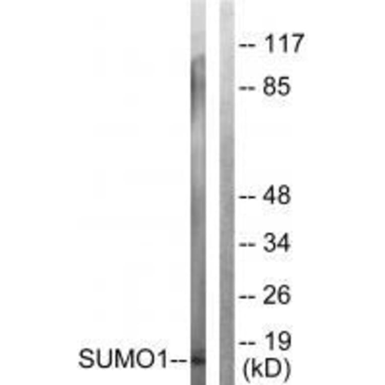 Western blot - Sumo1 Antibody from Signalway Antibody (33525) - Antibodies.com