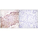 Immunohistochemistry - Sumo1 Antibody from Signalway Antibody (33525) - Antibodies.com