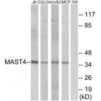 Western blot analysis of extracts from Jurkat cells, COLO cells, HUVEC cells and MCF-7 cells, using MAST4 antibody #33575.