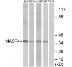 Western blot - MAST4 Antibody from Signalway Antibody (33575) - Antibodies.com