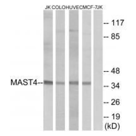 Western blot - MAST4 Antibody from Signalway Antibody (33575) - Antibodies.com