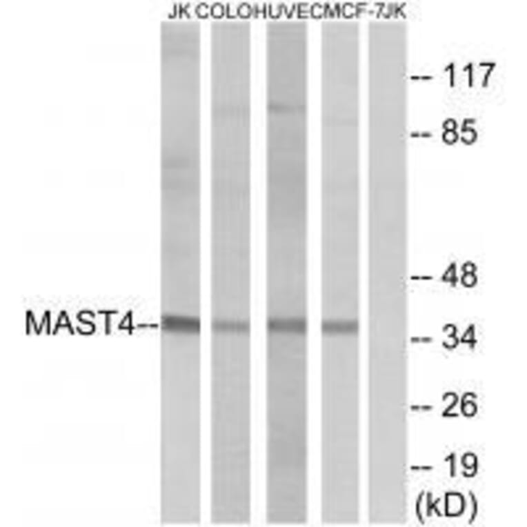 Western blot - MAST4 Antibody from Signalway Antibody (33575) - Antibodies.com