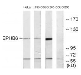 Western blot - EPHB6 Antibody from Signalway Antibody (33577) - Antibodies.com