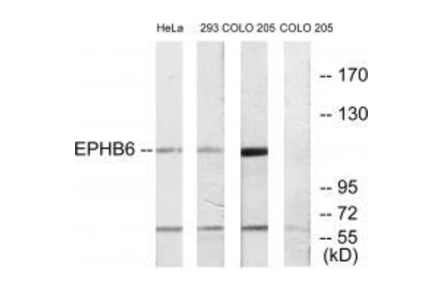Western blot - EPHB6 Antibody from Signalway Antibody (33577) - Antibodies.com