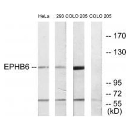 Western blot - EPHB6 Antibody from Signalway Antibody (33577) - Antibodies.com