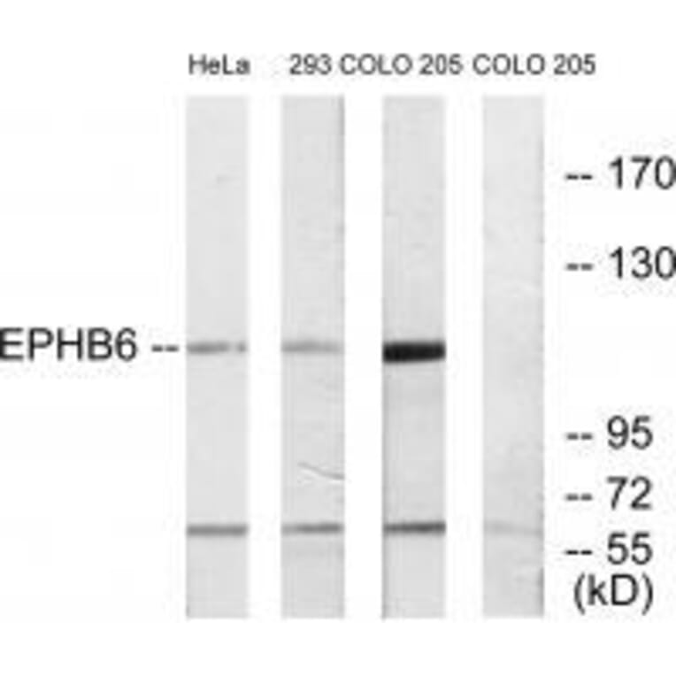 Western blot - EPHB6 Antibody from Signalway Antibody (33577) - Antibodies.com