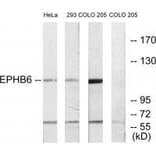 Western blot - EPHB6 Antibody from Signalway Antibody (33577) - Antibodies.com