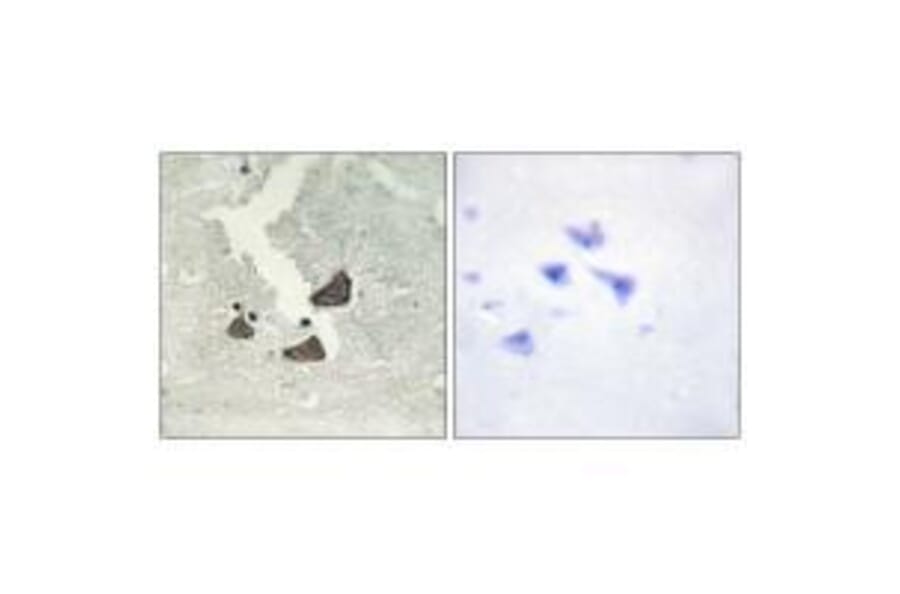 Immunohistochemistry - EPHB6 Antibody from Signalway Antibody (33577) - Antibodies.com