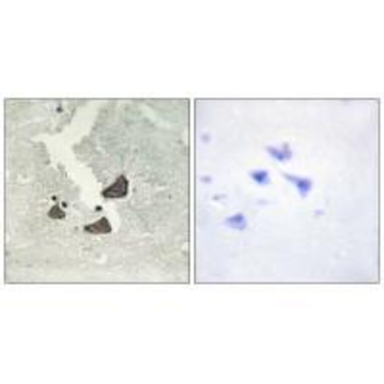 Immunohistochemistry - EPHB6 Antibody from Signalway Antibody (33577) - Antibodies.com