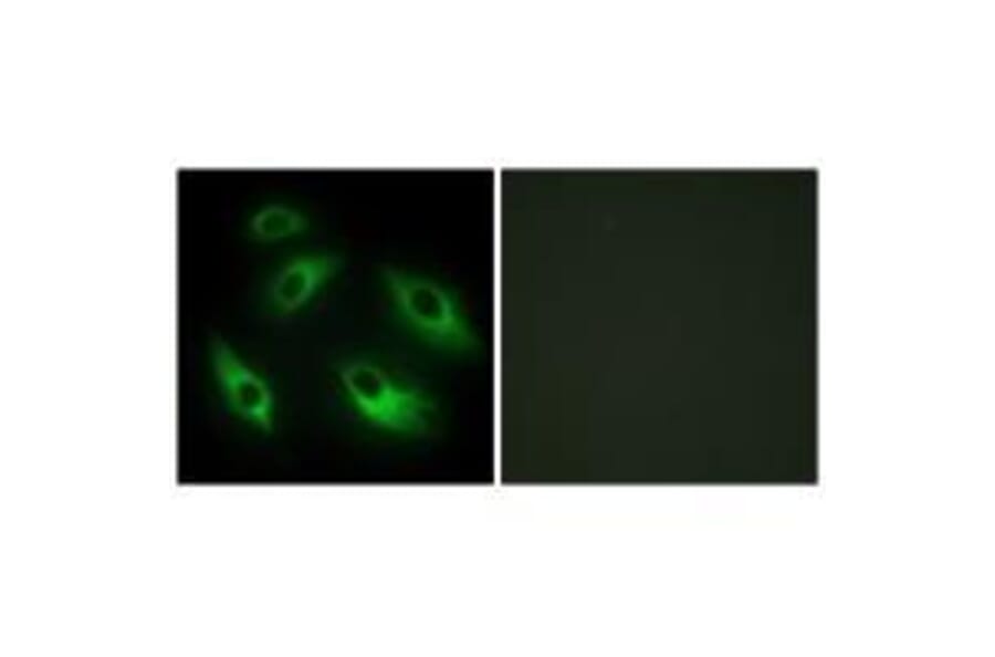 Immunofluorescence - EPHB6 Antibody from Signalway Antibody (33577) - Antibodies.com