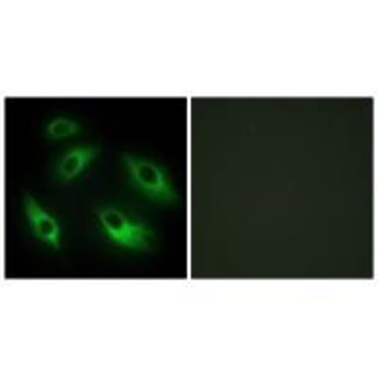 Immunofluorescence - EPHB6 Antibody from Signalway Antibody (33577) - Antibodies.com