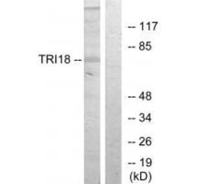 Western blot - TRI18 Antibody from Signalway Antibody (33578) - Antibodies.com