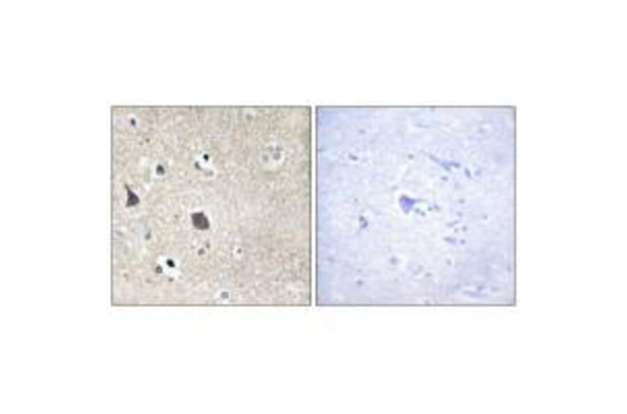 Immunohistochemistry - TRI18 Antibody from Signalway Antibody (33578) - Antibodies.com