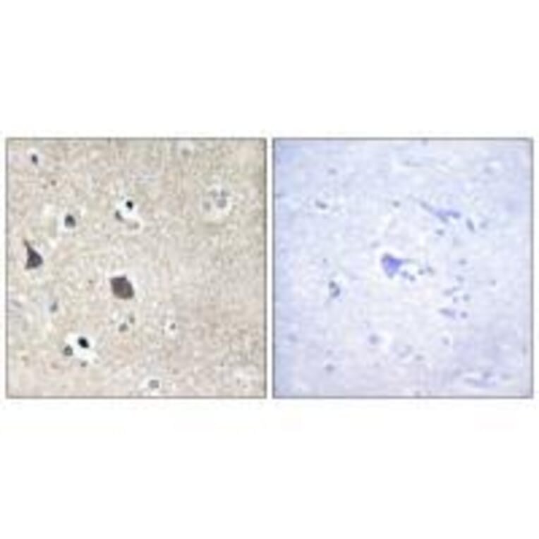 Immunohistochemistry - TRI18 Antibody from Signalway Antibody (33578) - Antibodies.com