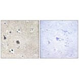Immunohistochemistry - TRI18 Antibody from Signalway Antibody (33578) - Antibodies.com