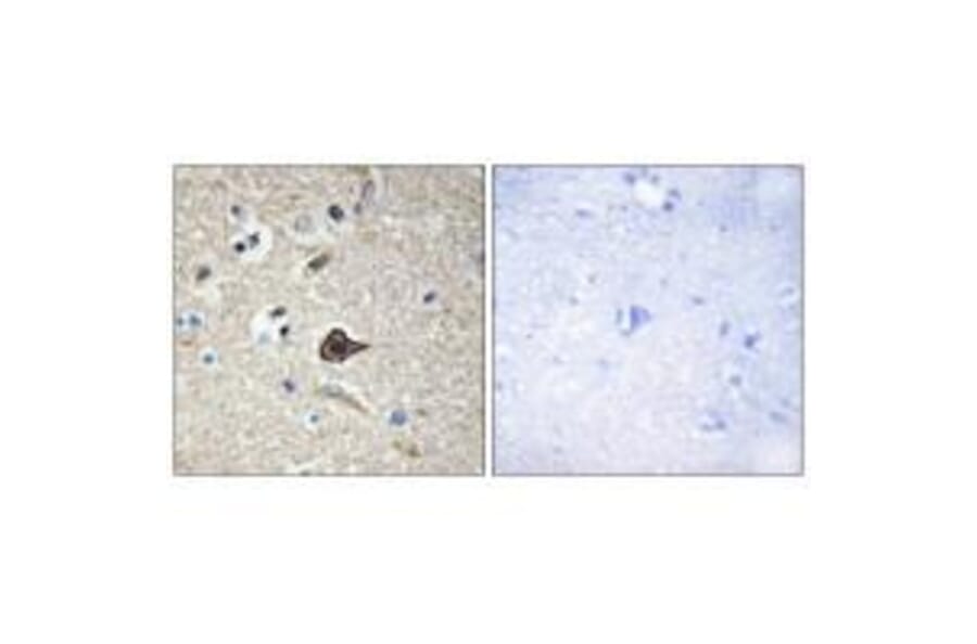 Immunohistochemistry - TNF12 Antibody from Signalway Antibody (33585) - Antibodies.com