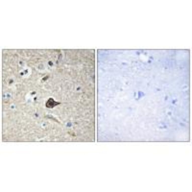 Immunohistochemistry - TNF12 Antibody from Signalway Antibody (33585) - Antibodies.com