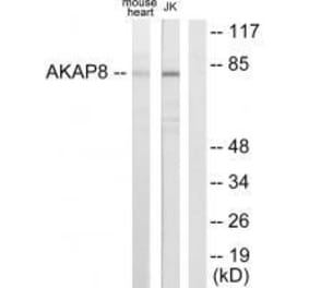 Western blot - AKAP8 Antibody from Signalway Antibody (33589) - Antibodies.com