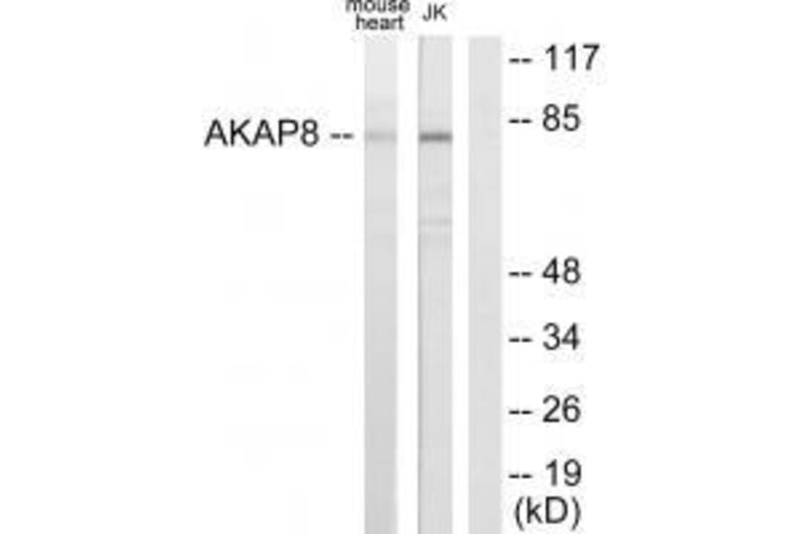 Western blot - AKAP8 Antibody from Signalway Antibody (33589) - Antibodies.com