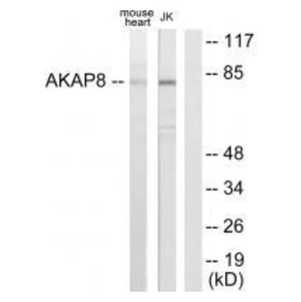 Western blot - AKAP8 Antibody from Signalway Antibody (33589) - Antibodies.com