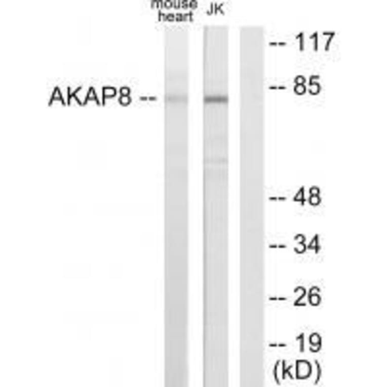 Western blot - AKAP8 Antibody from Signalway Antibody (33589) - Antibodies.com