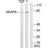 Western blot - AKAP8 Antibody from Signalway Antibody (33589) - Antibodies.com