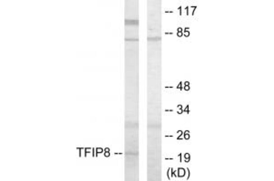 Western blot - TFIP8 Antibody from Signalway Antibody (33631) - Antibodies.com