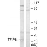 Western blot - TFIP8 Antibody from Signalway Antibody (33631) - Antibodies.com