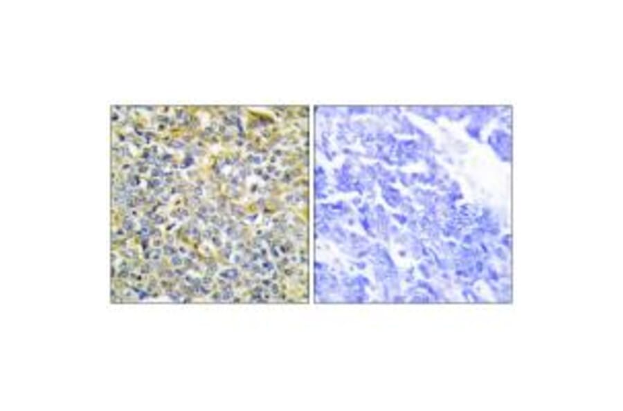 Immunohistochemistry - TFIP8 Antibody from Signalway Antibody (33631) - Antibodies.com