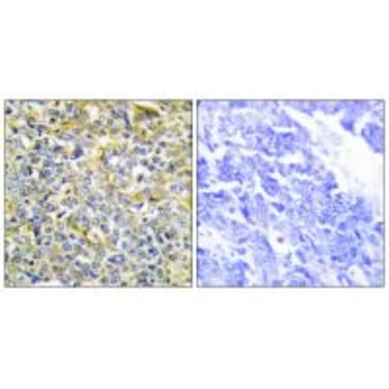 Immunohistochemistry - TFIP8 Antibody from Signalway Antibody (33631) - Antibodies.com