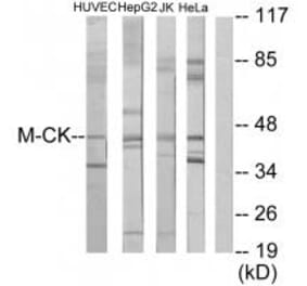 Western blot - M-CK Antibody from Signalway Antibody (33654) - Antibodies.com