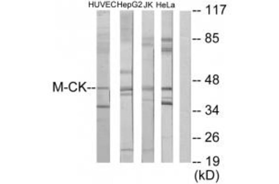 Western blot - M-CK Antibody from Signalway Antibody (33654) - Antibodies.com