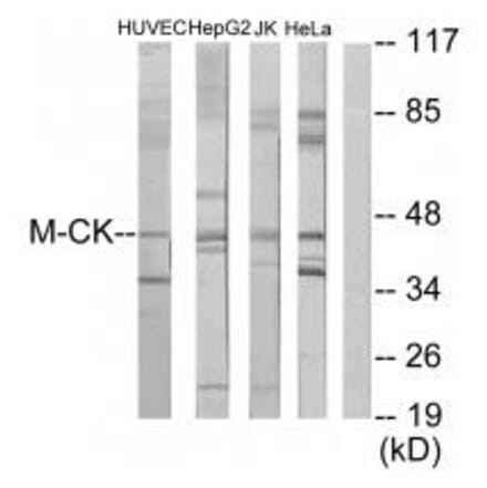 Western blot - M-CK Antibody from Signalway Antibody (33654) - Antibodies.com
