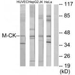 Western blot - M-CK Antibody from Signalway Antibody (33654) - Antibodies.com