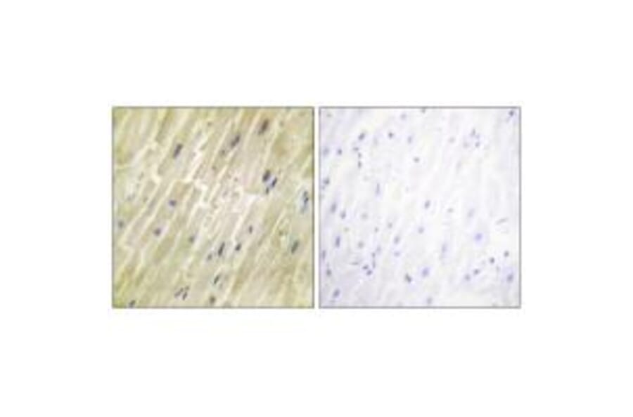 Immunohistochemistry - M-CK Antibody from Signalway Antibody (33654) - Antibodies.com
