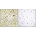 Immunohistochemistry - M-CK Antibody from Signalway Antibody (33654) - Antibodies.com