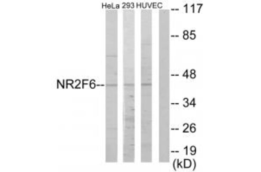 Western blot - NR2F6 Antibody from Signalway Antibody (33668) - Antibodies.com