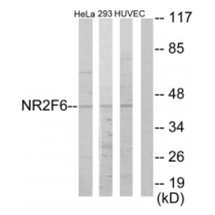 Western blot - NR2F6 Antibody from Signalway Antibody (33668) - Antibodies.com