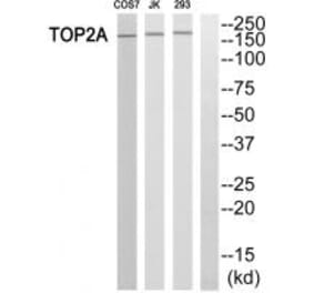Western blot - TOP2A Antibody from Signalway Antibody (33671) - Antibodies.com