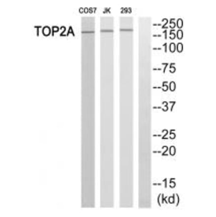 Western blot - TOP2A Antibody from Signalway Antibody (33671) - Antibodies.com