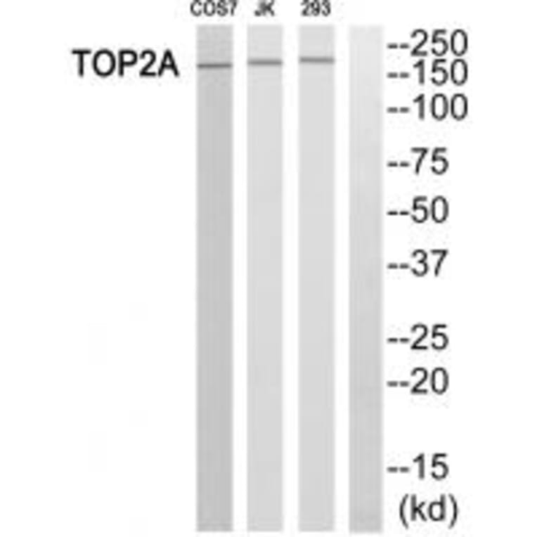 Western blot - TOP2A Antibody from Signalway Antibody (33671) - Antibodies.com