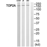 Western blot - TOP2A Antibody from Signalway Antibody (33671) - Antibodies.com
