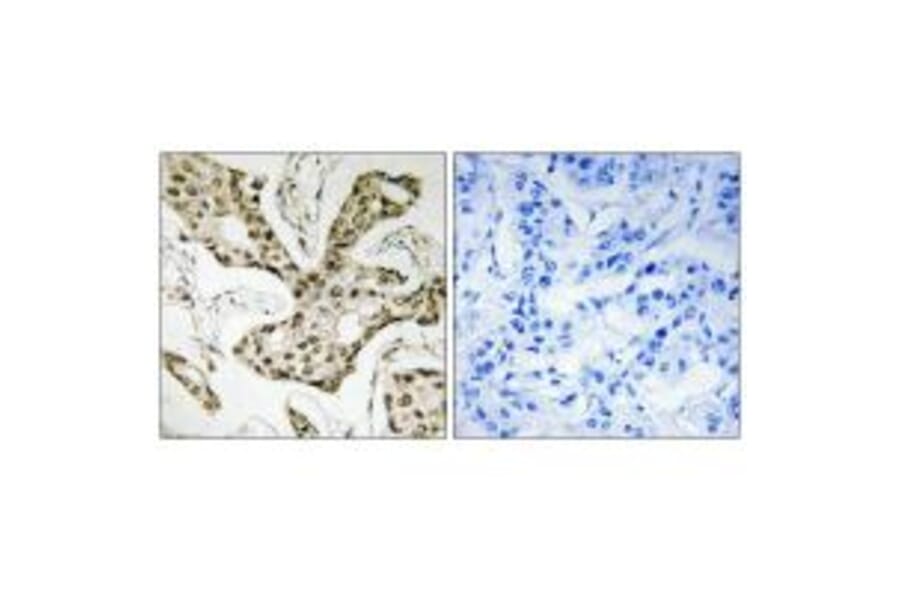 Immunohistochemistry - TOP2A Antibody from Signalway Antibody (33671) - Antibodies.com